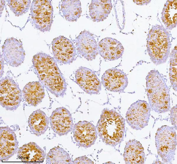 SPA17 Antibody