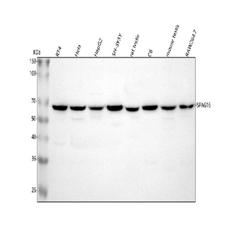 SPAG16 Rabbit Polyclonal Antibody