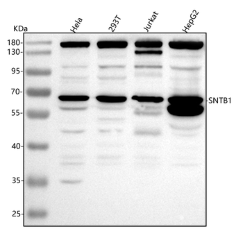 SNTB1 Rabbit Polyclonal Antibody