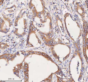 SCAMP3 Antibody