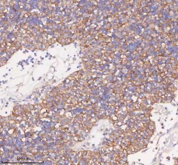 SCAMP3 Antibody