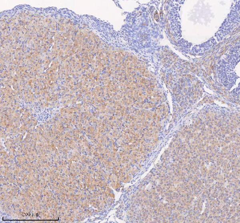 SCAMP3 Antibody