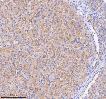 SCAMP3 Antibody