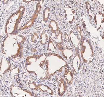SCAMP3 Antibody