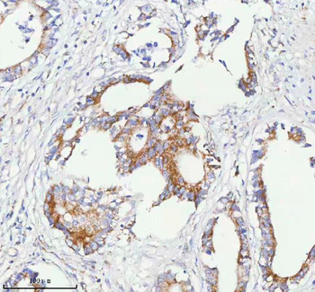 SASS6 Antibody