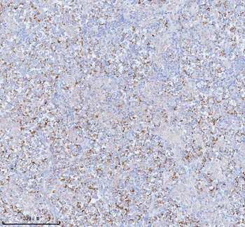 SASS6 Antibody