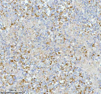 SASS6 Antibody