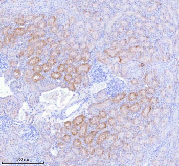 SASS6 Antibody