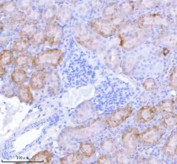 SASS6 Antibody