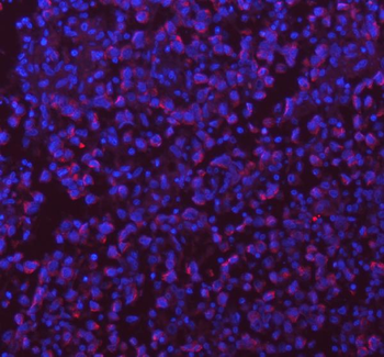SASS6 Antibody
