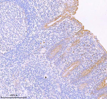 SASS6 Antibody