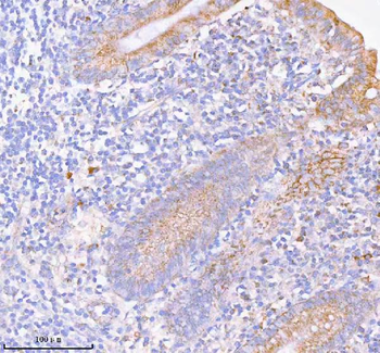 SASS6 Antibody