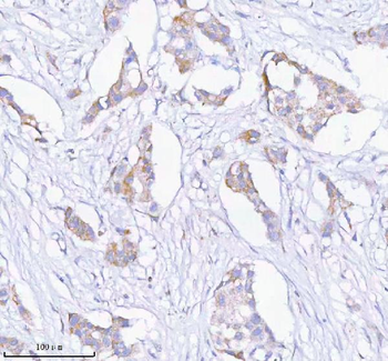 SASS6 Antibody