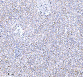 SASS6 Antibody
