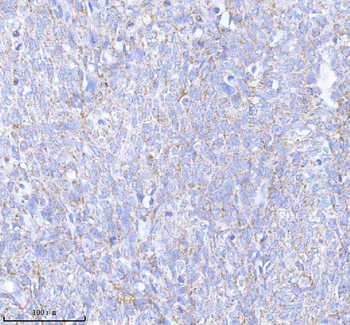 SASS6 Antibody