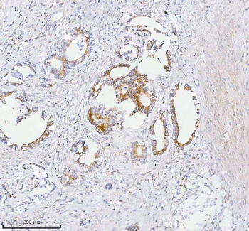 SASS6 Antibody