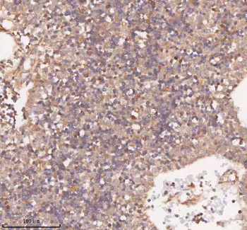 SAMD9L Antibody