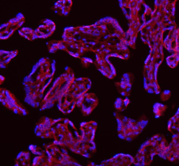 SAMD9L Antibody