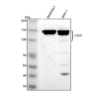 CD21/CR2 Rabbit Polyclonal Antibody