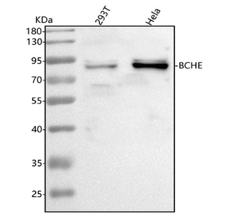 BCHE Rabbit Polyclonal Antibody