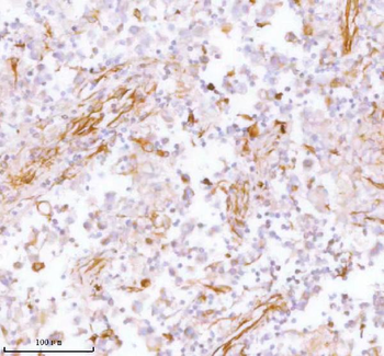 Stanniocalcin 2/STC2 Antibody
