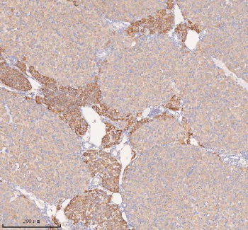 COQ8B Antibody