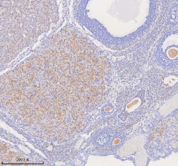 COQ8B Antibody