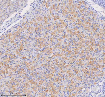 COQ8B Antibody