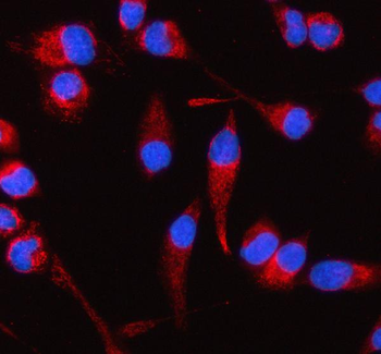 COQ8B Antibody