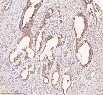 COQ8B Antibody