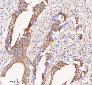 COQ8B Antibody