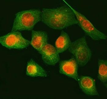 NUP88 Rabbit Polyclonal Antibody