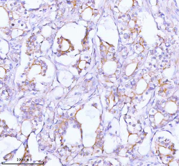 TNIK Antibody