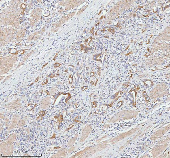TNIK Antibody
