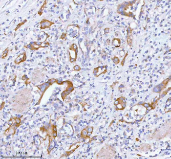 TNIK Antibody