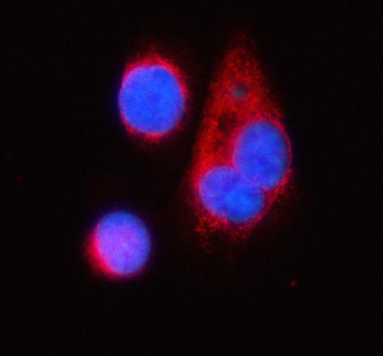TNIK Antibody