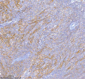 TNIK Antibody