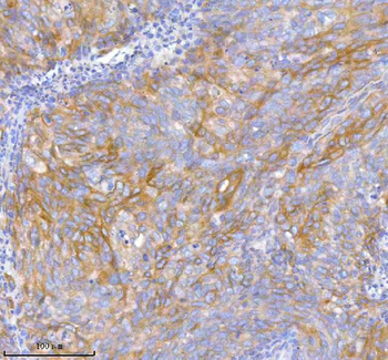 TNIK Antibody