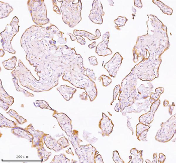 TNIK Antibody