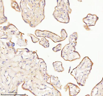 TNIK Antibody