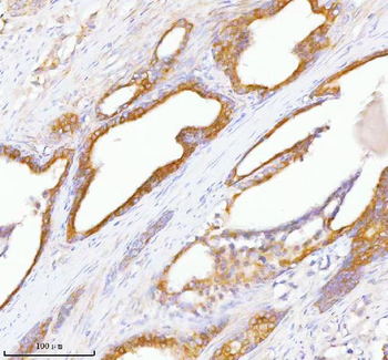 TNIK Antibody