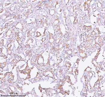 TNIK Antibody