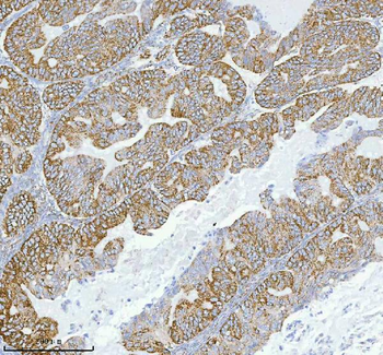 HERP/HERPUD1 Antibody