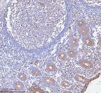 HERP/HERPUD1 Antibody
