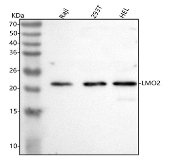 LMO2 Rabbit Polyclonal Antibody