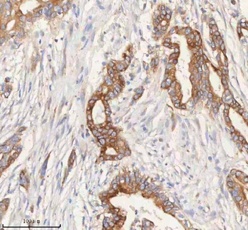 ERBB4 Rabbit Polyclonal Antibody