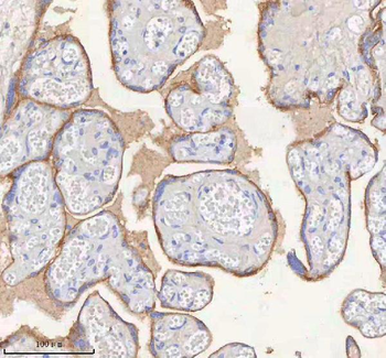 ERBB4 Rabbit Polyclonal Antibody