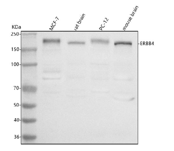 ERBB4 Rabbit Polyclonal Antibody