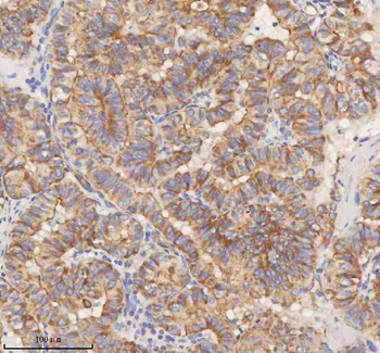 STIM1 Antibody
