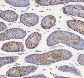STIM1 Antibody